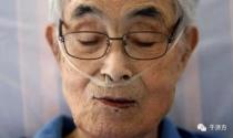是什么征服了70岁日本大叔的肺癌？日本药学博士久乡晴彦讲述的桑黄故事